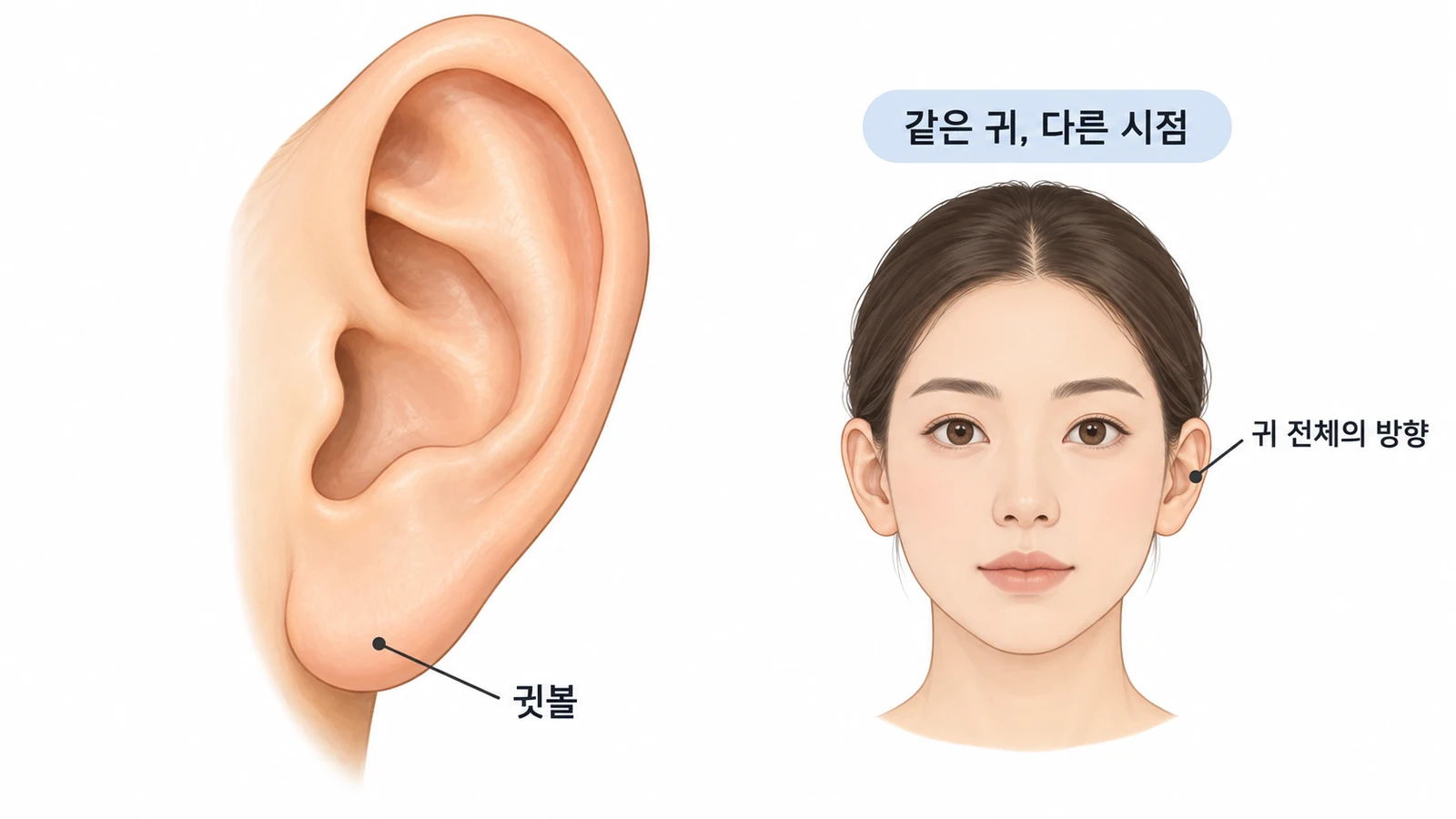 같은 귀를 측면과 정면에서 보며 귓볼 위치와 귀 전체의 방향을 구분한 설명 그림